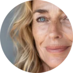 lëkurë_rrudhëza_rrudha